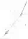 Fig. 02 - RAPID EXCHANGE VENA CAVA FILTER CATHETER AND METHOD OF USE