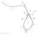 Fig. 01 - Adjustable suture button construct
