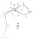 Fig. 02 - Adjustable suture button construct