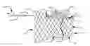 Fig. 01 - Paravalvular leak occlusion device for self-expanding heart valves