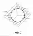 Fig. 03 - Paravalvular leak occlusion device for self-expanding heart valves