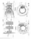 Fig. 10 - Paravalvular leak occlusion device for self-expanding heart valves