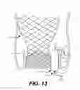 Fig. 16 - Paravalvular leak occlusion device for self-expanding heart valves