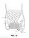 Fig. 19 - Paravalvular leak occlusion device for self-expanding heart valves
