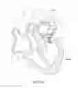 Fig. 06 - Prosthetic leaflet device