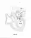 Fig. 15 - Prosthetic leaflet device