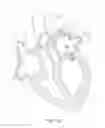 Fig. 28 - Prosthetic leaflet device