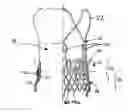 Fig. 01 - Transcatheter stent-valves