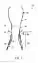 Fig. 02 - Transcatheter stent-valves