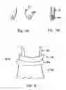 Fig. 06 - Transcatheter stent-valves
