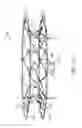Fig. 02 - System and method for cardiac valve repair and replacement