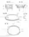 Fig. 07 - Methods for anchoring a device at a native heart valve annulus