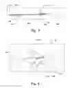 Fig. 03 - System and a method for delivery of an annuloplasty implant
