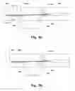 Fig. 05 - System and a method for delivery of an annuloplasty implant