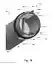 Fig. 10 - System and a method for delivery of an annuloplasty implant