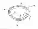 Fig. 01 - Heart valve sizing ring and method