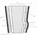 Fig. 01 - Implant With Improved Surface Properties and Expansion Means