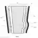 Fig. 02 - Implant With Improved Surface Properties and Expansion Means