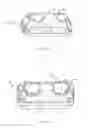 Fig. 02 - Glenoid implant and method of use thereof