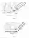 Fig. 05 - Glenoid implant and method of use thereof