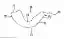 Fig. 01 - PROXIMAL CARPAL ROW IMPLANT