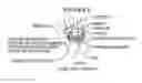 Fig. 05 - PROXIMAL CARPAL ROW IMPLANT