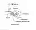 Fig. 06 - PROXIMAL CARPAL ROW IMPLANT