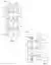 Fig. 04 - Systems and methods for treating spinal deformities