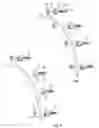 Fig. 05 - Systems and methods for treating spinal deformities