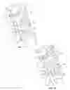 Fig. 07 - Systems and methods for treating spinal deformities