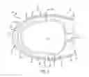 Fig. 04 - Interbody spinal fusion device