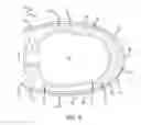 Fig. 05 - Interbody spinal fusion device