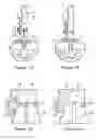 Fig. 05 - Holder for an acetabular cup implant