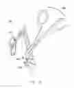 Fig. 23 - Interlaminar Fixation Device