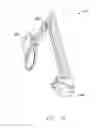 Fig. 25 - Interlaminar Fixation Device