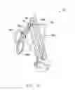 Fig. 30 - Interlaminar Fixation Device