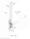 Fig. 56 - Interlaminar Fixation Device