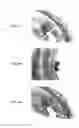 Fig. 08 - Stents having protruding drug-delivery features and associated systems and methods