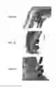 Fig. 09 - Stents having protruding drug-delivery features and associated systems and methods
