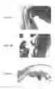 Fig. 11 - Stents having protruding drug-delivery features and associated systems and methods