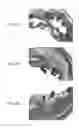 Fig. 12 - Stents having protruding drug-delivery features and associated systems and methods