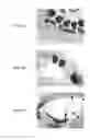 Fig. 18 - Stents having protruding drug-delivery features and associated systems and methods