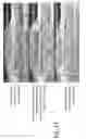 Fig. 12 - Delivery balloon with retractable retention cuffs