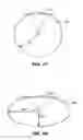 Fig. 04 - STENT DELIVERY SYSTEMS WITH SHAPED EXPANSION BALLOONS