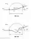 Fig. 06 - STENT DELIVERY SYSTEMS WITH SHAPED EXPANSION BALLOONS