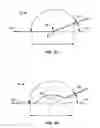 Fig. 07 - STENT DELIVERY SYSTEMS WITH SHAPED EXPANSION BALLOONS