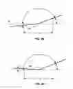 Fig. 09 - STENT DELIVERY SYSTEMS WITH SHAPED EXPANSION BALLOONS