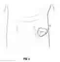 Fig. 03 - Stomal diverter device