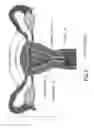 Fig. 03 - Fallopian biocompatible plug with differently expandable portions