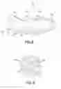 Fig. 07 - Fallopian biocompatible plug with differently expandable portions